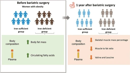 Iron Deficiency Is Associated with Increased Circulating Fatty Acids and Unfavorable Body Composition in Women with Obesity