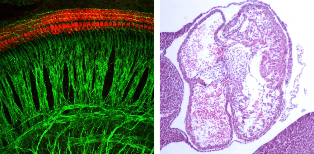 BIOCEV: intro - cochlea and heart.
