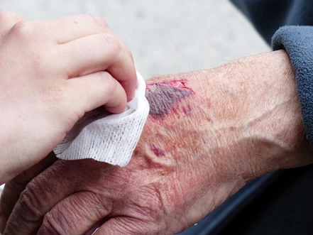 Analysis of Emerging Contaminants Series, Part I: Identification of Iodinated Disinfection Byproducts by GC-MS/MS